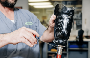 Brian Mueller adjusts a carbon-fiber prosthesis in the lab. Around 70 percent of the patients in UAB’s Amputee Clinic have lost a limb due to vascular/circulatory disease or diabetes. These inter-related diagnoses are closely tied to aging, and the clinic is getting busier as the population gets older.
