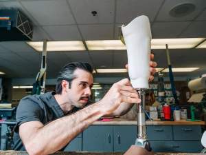 UAB Amputee Clinic employee working with 3D-printed prosthetic technology